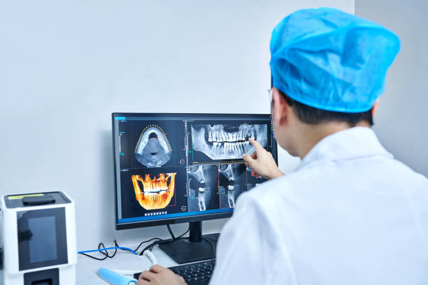 Best Emergency Root Canal Treatment in Stro Valley, CA