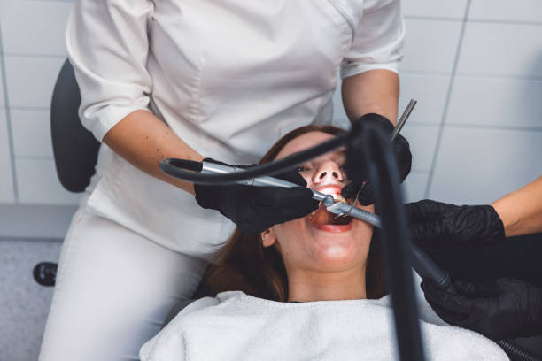 Best Emergency Wisdom Teeth Removal in Stro Valley, CA